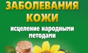Заболевания кожи и их лечение народными средствами