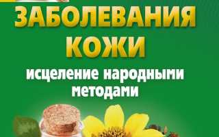 Заболевания кожи и их лечение народными средствами
