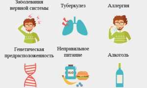 Как облегчить боль при артрите в домашних условиях: практические советы и подходы