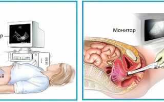 УЗИ – что это такое и для чего его используют в медицине