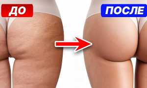 Как избавиться от целлюлита и сделать ноги стройными
