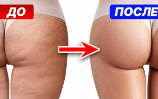 Как избавиться от целлюлита и сделать ноги стройными