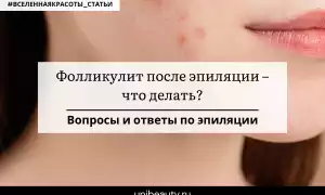 Как снять раздражение после эпиляции – несколько способов