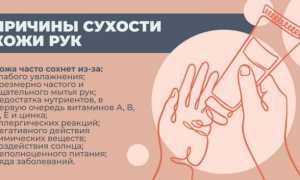 Причины сухости кожи рук – как бороться