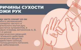 Причины сухости кожи рук – как бороться