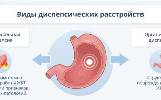 Диспепсия (расстройство желудка) – причины, симптомы, методы лечения
