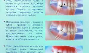 Почему не стоит откладывать лечение зубов последствия промедления