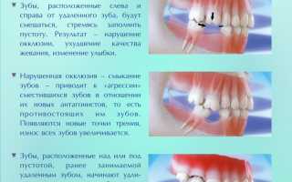 Почему не стоит откладывать лечение зубов последствия промедления