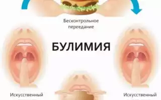 Булимия – что это за заболевание и чем оно опасно