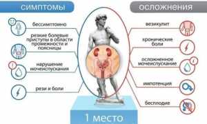 Причины простатита у мужчин – 10 условий появления заболевания