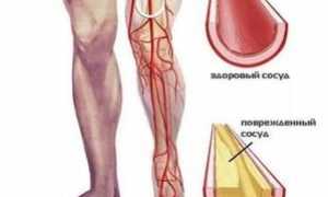 Как улучшить кровообращение в ногах