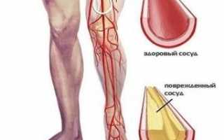 Как улучшить кровообращение в ногах