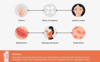 Пантеноловая мазь: от чего помогает и как правильно применять