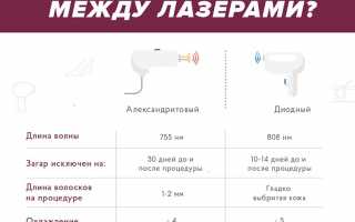 Диодный, александритовый или неодимовый: какой лазер выбрать для эпиляции?