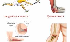 Боль в локтях: почему болит локоть