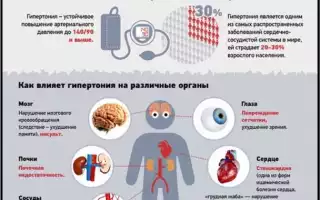 Гипертония – причины, симптомы, лечение и группы риска