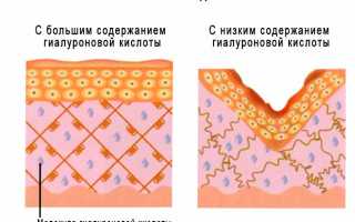 Гиалуроновая кислота – почему о ней так много говорят?