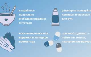 Как укрепить ногти в домашних условиях
