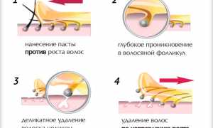 Сахарная эпиляция — как сделать шугаринг дома