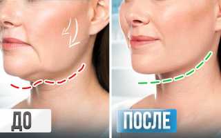 Как убрать обвисшие щеки – домашний лифтинг, упражнения, маски