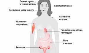 Анорексия – причины, симптомы и лечение