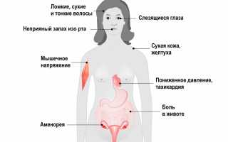 Анорексия – причины, симптомы и лечение