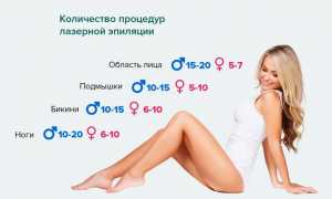 Лазерная эпиляция: когда стоит начинать курс процедур