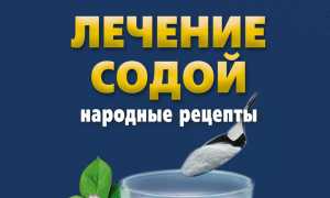 Лечение пищевой содой – народные рецепты
