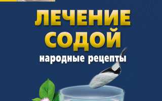Лечение пищевой содой – народные рецепты