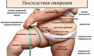 Как ожирение влияет на здоровье женщины