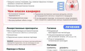 Молочница у беременных – причины, симптомы, лечение