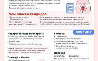 Молочница у беременных – причины, симптомы, лечение