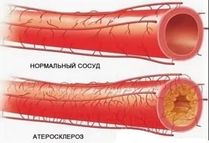 сосуды