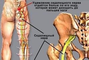 zashhemlenie