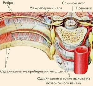 nevralgiya-simptomy