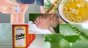 Укусы насекомых